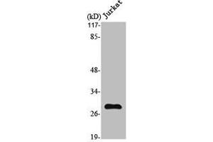Western Blot analysis of Jurkat cells using MMP-7 Polyclonal Antibody (MMP7 antibody  (C-Term))