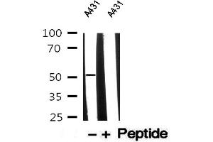 Western blot analysis of A431 whole cell lysates, using Cytokeratin 13 Antibody. (Cytokeratin 13 antibody  (Internal Region))