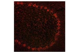 ADAM15 antibody used at a concentration of 10 ug/ml to detect cytoplasmin neurons in rodent brain (red). (ADAM15 antibody  (Middle Region))