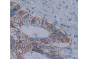 IHC-P analysis of Human Tissue, with DAB staining. (Anoctamin 6 antibody  (AA 744-824))