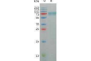 Human DL2 Protein, hFc Tag on SDS-PAGE under reducing condition. (KIR2DL2 Protein (AA 22-245) (Fc Tag))