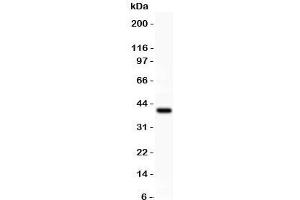 Western blot testing of Perforin antibody and recombinant human protein (0. (Perforin 1 antibody  (AA 175-555))