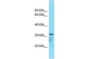 Host: Rabbit Target Name: C8orf74 Sample Type: COLO205 Whole Cell lysates Antibody Dilution: 1. (C8ORF74 antibody  (C-Term))