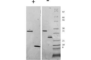 SDS-PAGE (SDS) image for Myostatin Propeptide protein (ABIN6700278)