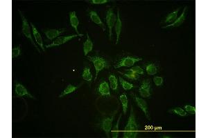 Immunofluorescence of monoclonal antibody to HTRA2 on HeLa cell. (HTRA2 antibody  (AA 359-458))