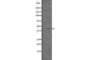 Western blot analysis of PKNOX1 expression in A431 whole cell lysate ,The lane on the left is treated with the antigen-specific peptide. (PKNOX1 antibody  (Internal Region))