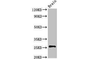 Western Blot Positive WB detected in: Rat brain tissue All lanes: ASCL1 antibody at 3 μg/mL Secondary Goat polyclonal to rabbit IgG at 1/50000 dilution Predicted band size: 26 kDa Observed band size: 26 kDa (ASCL1 antibody  (AA 1-236))