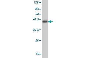 Western Blot detection against Immunogen (38. (NEK2 antibody  (AA 331-445))