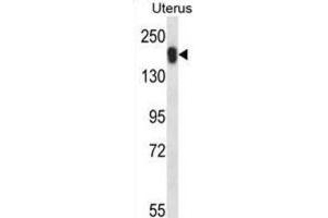 Western Blotting (WB) image for anti-Ubiquitin Specific Peptidase 43 (USP43) antibody (ABIN2997870) (USP43 antibody)