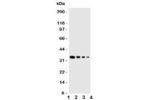 Western blot testing of GCN2 antbody (GCN2 antibody  (Middle Region))