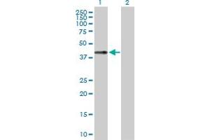 Western Blot analysis of LECT1 expression in transfected 293T cell line by LECT1 MaxPab polyclonal antibody. (LECT1 antibody  (AA 1-334))