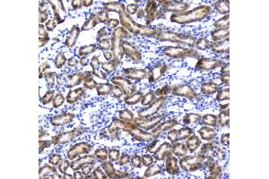 IHC analysis of Regucalcin using anti-Regucalcin antibody . (Regucalcin antibody)