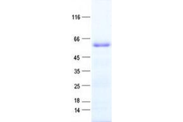 ZNF136 Protein (His tag)