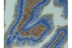 Used in DAB staining on fromalin fixed paraffin- embedded tissue (NOS2 antibody  (AA 43-213))