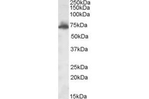 Western Blotting (WB) image for anti-A Kinase (PRKA) Anchor Protein 10 (AKAP10) (AA 28-40) antibody (ABIN290931) (AKAP10 antibody  (AA 28-40))