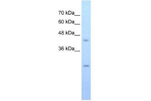 FLJ20489 antibody used at 0. (FLJ20489 (C-Term) antibody)