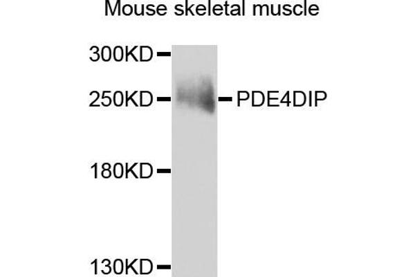 PDE4DIP antibody