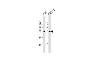 All lanes : Anti-mouse BAD Antibody at 1:1000 dilution Lane 1: A20 whole cell lysate Lane 2: C2C12 whole cell lysate Lysates/proteins at 20 μg per lane. (BAD antibody  (AA 90-118))