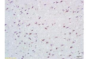 Formalin-fixed and paraffin embedded rat brain tissue labeled with Anti-Cathepsin B Polyclonal Antibody, Unconjugated at 1:200 followed by conjugation to the secondary antibody, (SP-0023), and DAB staining (Cathepsin B antibody  (AA 251-339))