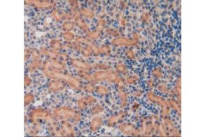 IHC-P analysis of kidney tissue, with DAB staining. (SHBG antibody  (AA 222-358))