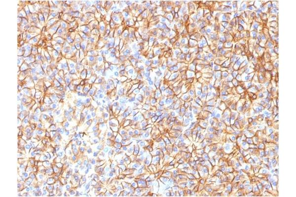 Spectrin, Beta, Non-erythrocytic 2 (SPTBN2) (AA 356-475) antibody