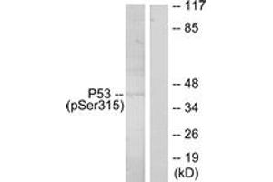 Western Blotting (WB) image for anti-Tumor Protein P53 (TP53) (pSer315) antibody (ABIN2888498) (p53 antibody  (pSer315))