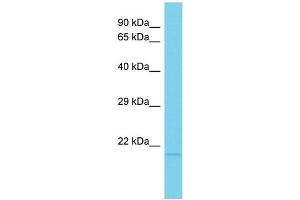 Host: Rabbit Target Name: C15orf53 Sample Type: HT1080 Whole Cell lysates Antibody Dilution: 1. (C15ORF53 antibody  (N-Term))