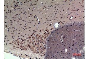 Immunohistochemistry (IHC) analysis of paraffin-embedded Rat Brain, antibody was diluted at 1:100. (CRHR1 antibody  (Internal Region))