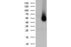 HEK293T cells were transfected with the pCMV6-ENTRY control (Left lane) or pCMV6-ENTRY HP (Right lane) cDNA for 48 hrs and lysed. (Haptoglobin antibody)