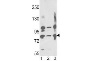 Western blot analysis of Neprilysin antibody and 1) A2058, 2) A375, 3) Ramos lysate. (MME antibody  (AA 506-534))