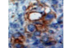 Used in DAB staining on fromalin fixed paraffin-embedded Ovary tissue (CD166 antibody  (AA 28-527))