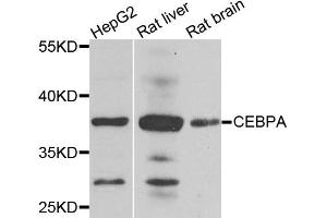 Western blot analysis of extracts of various cell lines, using CEBPA antibody (ABIN6003503) at 1/1000 dilution. (CEBPA antibody)