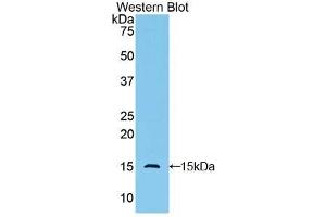 Western blot analysis of the recombinant protein. (GLG1 antibody  (AA 1048-1145))