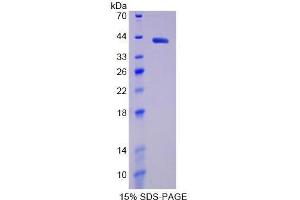 SDS-PAGE (SDS) image for Hypoxia Inducible Factor 1, alpha Subunit (Basic Helix-Loop-Helix Transcription Factor) (HIF1A) (AA 218-506) protein (His tag) (ABIN2125227) (HIF1A Protein (AA 218-506) (His tag))