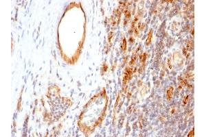 Formalin-fixed, paraffin-embedded human Tonsil stained with CD31 Monoclonal Antibody (1A10) (CD31 antibody  (Extracellular Domain))