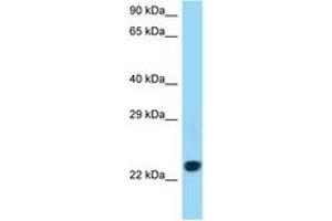 Image no. 1 for anti-CD86 (CD86) (C-Term) antibody (ABIN6747996) (CD86 antibody  (C-Term))