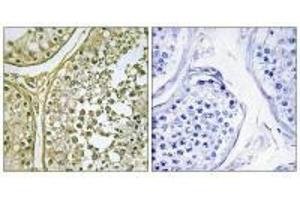 Immunohistochemistry analysis of paraffin-embedded human testis tissue, using CKI-α1/L antibody. (CSNK1A1L/CSNK1A1 antibody)