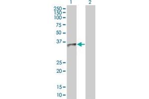 Western Blotting (WB) image for UCP2 293T Cell Transient Overexpression Lysate(Denatured) (ABIN1333846)