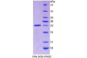 SDS-PAGE analysis of Human ALDH1A3 Protein. (ALDH1A3 Protein)