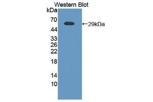 Western Blotting (WB) image for anti-Nicotinamide phosphoribosyltransferase (NAMPT) (AA 1-491) antibody (ABIN1863297) (NAMPT antibody  (AA 1-491))