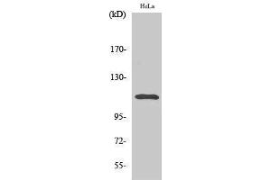 Western Blotting (WB) image for anti-Signal Transducer and Activator of Transcription 2, 113kDa (STAT2) (pTyr690) antibody (ABIN3179629) (STAT2 antibody  (pTyr690))