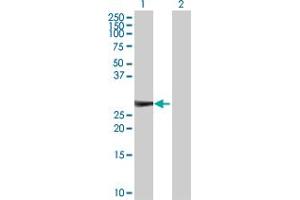 Western Blot analysis of KIRREL2 expression in transfected 293T cell line by KIRREL2 MaxPab polyclonal antibody. (KIRREL2 antibody  (AA 1-219))