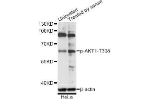Western blot analysis of extracts of HeLa cells, using Phospho-AKT1-T308 antibody (ABIN5969955) at 1/2000 dilution. (AKT1 antibody  (pThr308))