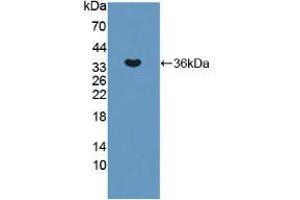Figure. (ERN1 antibody  (AA 571-832))