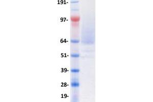 Validation with Western Blot (PODXL Protein (Transcript Variant 2) (DYKDDDDK-His Tag))