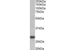 Western Blotting (WB) image for anti-Thyroid Stimulating Hormone Receptor (TSHR) (Internal Region) antibody (ABIN2464943) (TSH receptor antibody  (Internal Region))