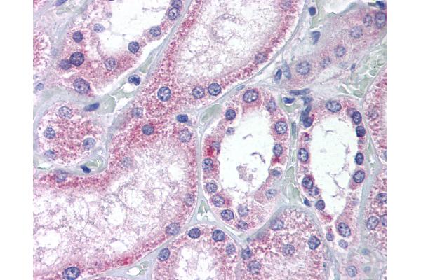 AADAT antibody  (Internal Region)