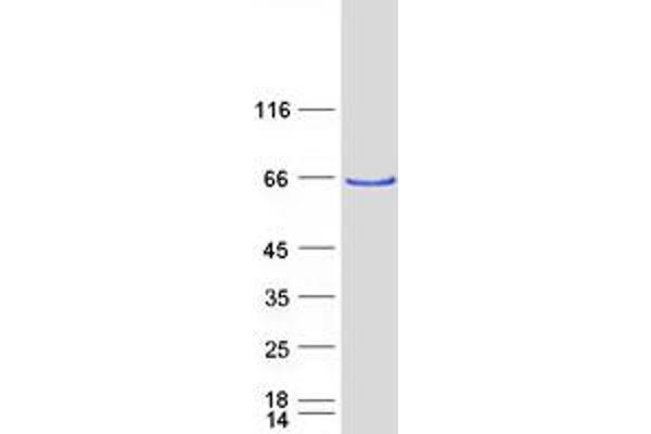 ATE1 Protein (Transcript Variant 2) (Myc-DYKDDDDK Tag)