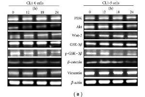 Western Blotting (WB) image for anti-Vimentin (VIM) antibody (ABIN2854814)