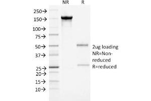 SDS-PAGE Analysis Purified Alpha-1-Antichymotrypsin Monoclonal Antibody (AACT/1452). (SERPINA3 antibody  (AA 49-187))